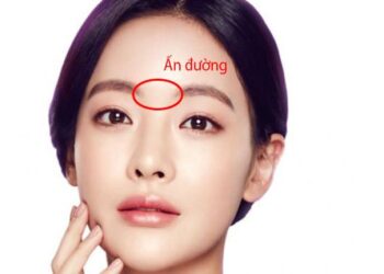31 vị trí nốt ruồi trên mặt thể hiện tài vận, tình duyên của bạn